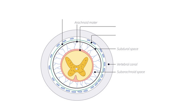 Transverse section of spinal cord, Medical illustration showing the spinal cord meninges and surrounding spaces in cross-section.