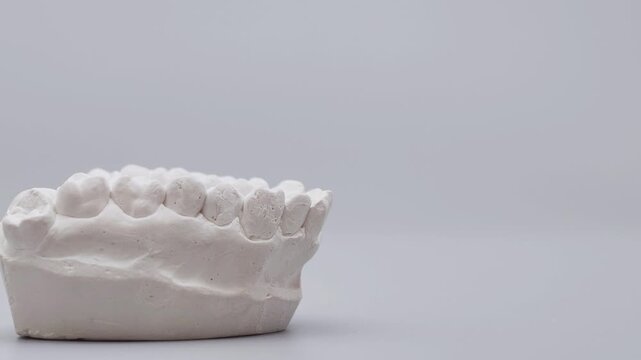 Dentist hand in blue glove removing clear aligner from plaster dental model using tweezers. Orthodontic concept with copy space