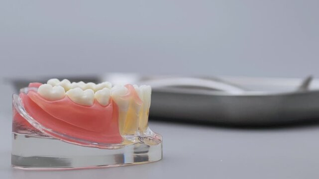 Metal Dental Crown Removal from Molar on Jaw Model