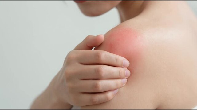 Sensitive skin allergic concept, Woman itching on her arm have a red rash from allergy symptom and from scratching