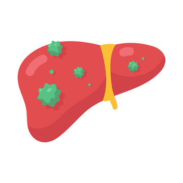Illustrative depiction of a human liver showing significant disease and green cancerous growths