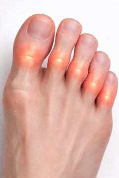 Close-up view of a foot with glowing toes on a white background, emphasizing skin texture and nail details for health and medical contexts