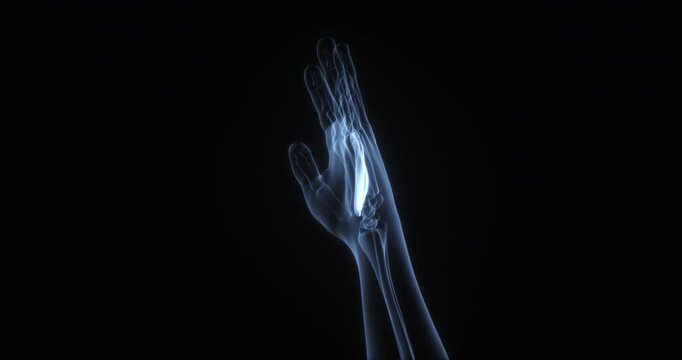 Hypothenar eminence muscle in human body. X Ray. Loop