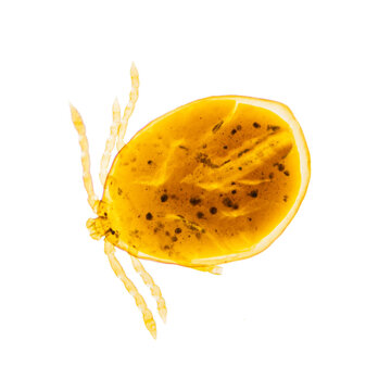 Hard ticks are parasites that attach to a host; their bites are painless, and they can transmit bacterial, protozoal, and viral diseases such as Lyme disease, encephalitis, and tularemia.Magnify 40x

