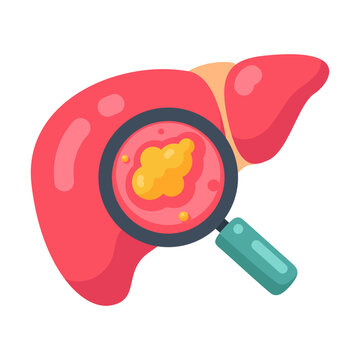 Magnifying glass revealing liver disease a concept of medical diagnosis and health