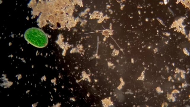 Bright green protozoan organism moving rapidly under dark field microscope

