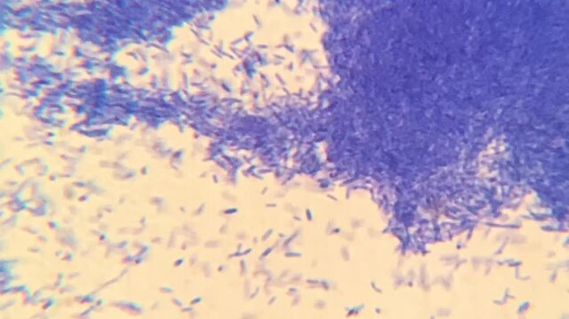 Crystal violet stained bacteria colony viewed under light microscope magnification
