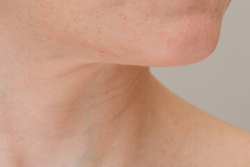 Venus Rings and loose and Detaching Skin on the Neck © Tatiana Foxy