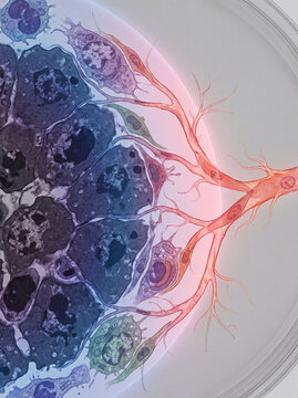 Scientific Illustration of Tumor Angiogenesis and Vascular Remodeling