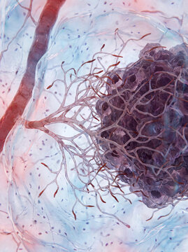 Endothelial Blood Vessel Sprouting During Cancer Tumor Growth