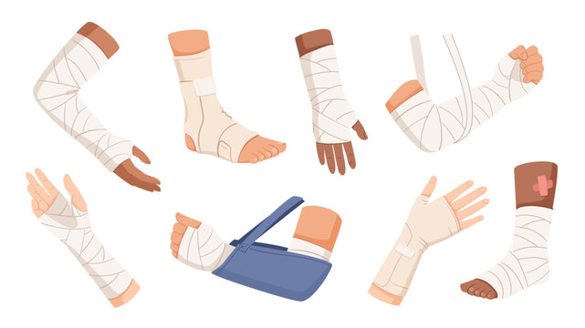 Bandaged body parts elements set design. Collection with injured hands, legs, ankles, arms, feets with first aid medical wraps, healing dressings applied on patient traumas. Vector illustration.