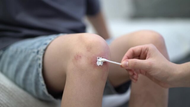 Caring mother gently applies healing ointment with a cotton swab to her son's scraped knee. Tender family moment of first aid and comfort at home, showing love and careful wound treatment.