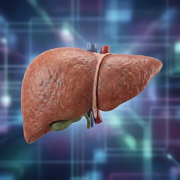 A full human liver organ showing uniform enlargement, pale color, and signs of fatty infiltration (steatosis), symbolizing Non-Alcoholic Fatty Liver Disease (NAFLD), in a misty, ethereal digital paint