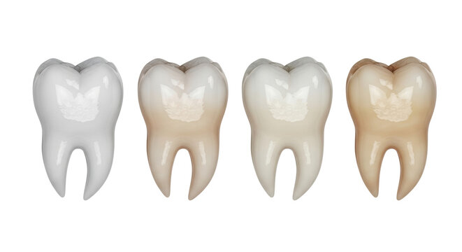 Four glossy human molar teeth in a horizontal row showing a color transition from white to natural yellow on a white background. concept of teeth whitening