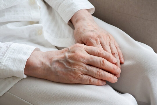 The hands of an elderly woman resting on her lap