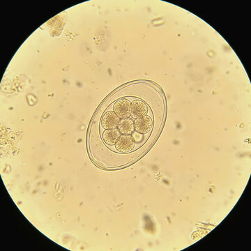 Microscopic View of Hookworm Egg (Ancylostoma duodenale) in Stool Sample