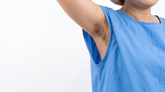 Dark Armpit Skin Hyperpigmentation and Skincare Healthcare Concept