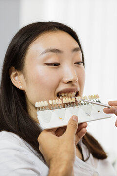 A woman's teeth are being matched with a shade guide by a dentist during a cosmetic dental procedure