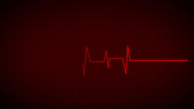 Heartbeat Monitor Animated Video, Heartbeat Medical Cardiogram Animation