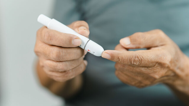 Close-up of a senior adult using a lancet device for finger prick blood glucose monitoring at home. Diabetes self-testing supports preventive healthcare, chronic disease management.