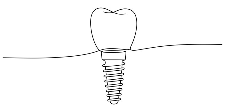 Continuous single line drawing of a dental implant with a tooth crown on a simple design
