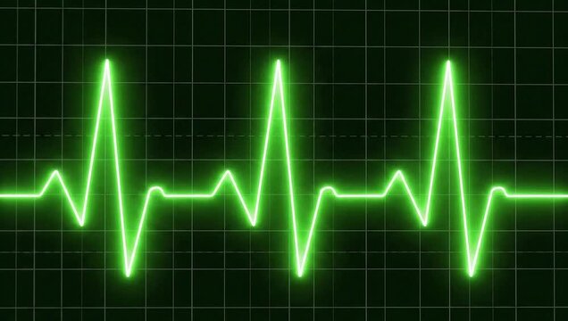 Electrocardiogram Heartbeat Line: A vibrant green electrocardiogram (ECG) waveform displayed on a grid, symbolizing life, health, and vital signs.