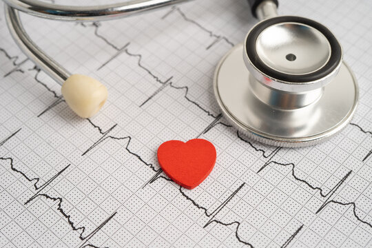 Electrocardiogram ECG, heart wave, heart attack, cardiogram report.