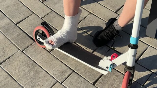 Top down view of an injured child's foot in a plaster cast placed on a kick scooter deck, childhood trauma, medical recovery, active lifestyle accident.