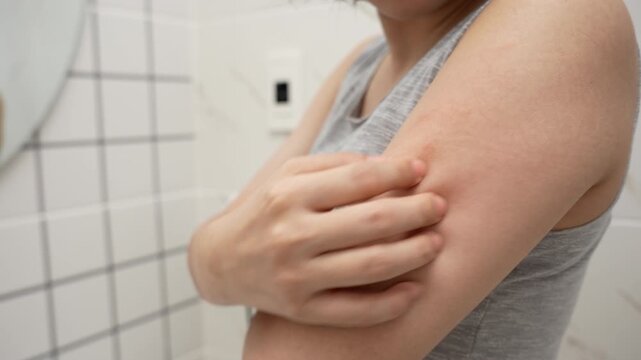 skin problem and beauty. woman scratch body has itchy skin from skin allergic, steroid allergy, sensitive skin, red from sunburn, chemical allergy, rash, insect bites, Seborrheic Dermatitis.