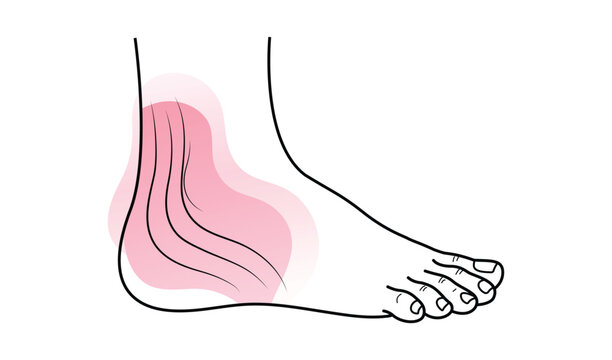 Handdrawn illustration of a foot with toes showing an injury or pain point vector