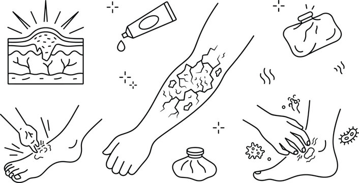 Skin Allergy Eczema Treatment Line Icons Set with Itchy Cracked Psoriasis Medical Symptoms