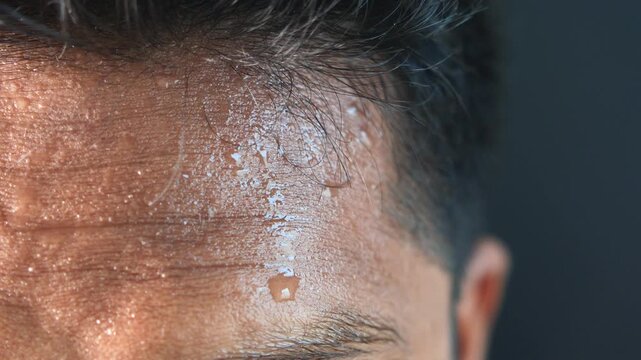 Close up of man's sweaty forehead with water droplets on skin during hot weather or exercise