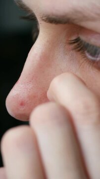 Close up young woman applying hydrocolloid pimple patch to treat blemish on face, common solution for skin problems, part of daily beauty routine. Person applying acne pimple patch treatment on face