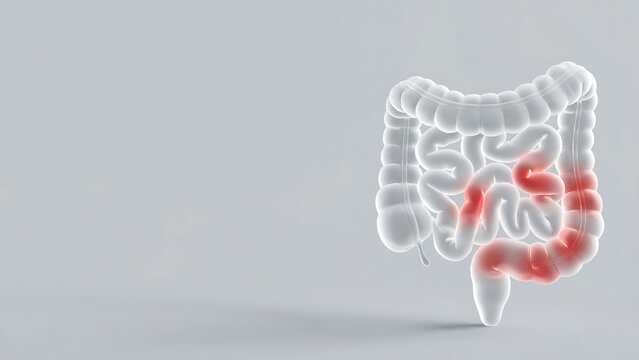 3D Medical Illustration of Human Intestines Highlighting Inflamed Areas of the Digestive System
