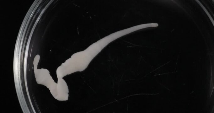 Cestode Larva (Cysticercus) and Strongyloides ratti Parasites in lab.