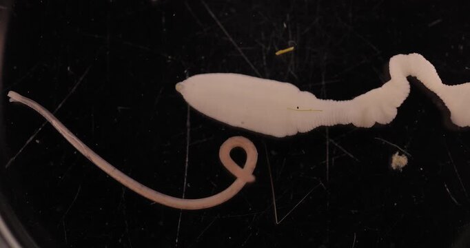 Cestode Larva (Cysticercus) and Strongyloides ratti Parasites in lab.