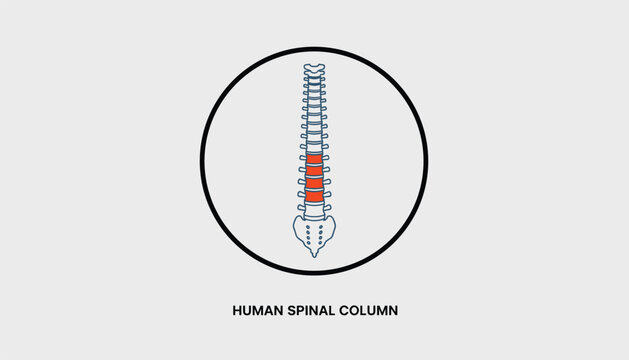 Spinal column diagram with highlighted orange lumbar vertebrae representing back pain or herniated disc.