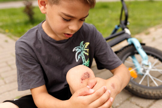 Little boy sitting on pavement looking at scratched wounded knee skin abrasion injury after fall from bicycle accident trauma first aid medical care summer activity childhood problems concept