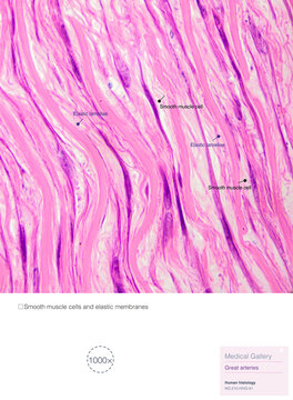 The tunica media of large arteries is primarily composed of smooth muscle cells and elastic fibers, typically consisting of 50 to 70 layers of elastic lamellae.Magnified 1000x
