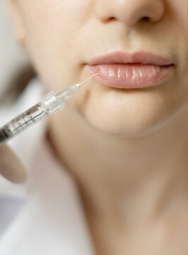 Lip Filler Injection Close-Up &mdash; Cosmetic Lip Augmentation Procedure