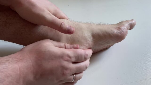 Man Massaging Painful Foot Heel and Arch Close Up