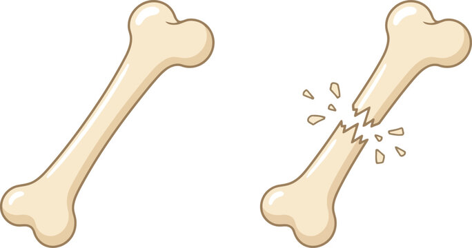 Intact and broken bone icon set