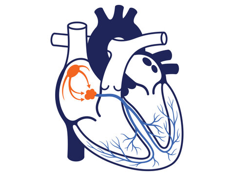 Heart conduction system and electrical pathway with conduction electrical cardiology physiology ventricle purkinje biomedical clinical healthcare medicine heartbeat cardiovascular
