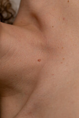 Naklejka premium Close-Up of Human Skin Texture with Benign Moles on Neck and Collarbone, Dermatology and Skin Health Concept