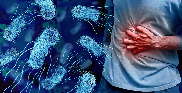 E Coli infection as severe stomach pain caused by pathogenic Escherichia coli bacteria spreading through the gut as an intestinal disease