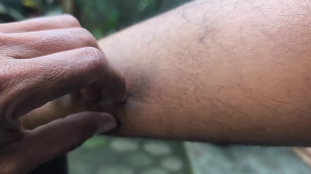 fingers scratching the skin of an adult's foot with fine hairs that look normal.