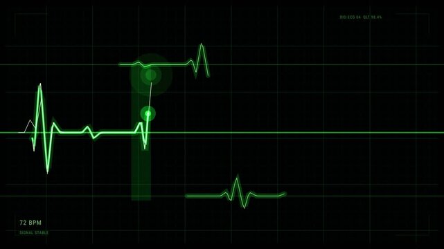 Heartbeat Measurement Monitor Tool With Green ECG Grid Learning Animation