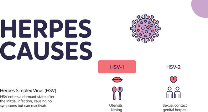 Herpes Causes Medical Vector Illustration Explaining HSV One and HSV Two Transmission Routes with Viral Infection Healthcare Educational Infographic Design