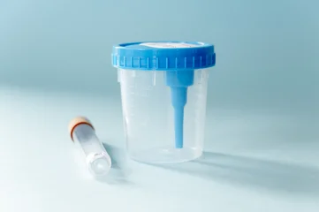 Urine sample collection jar and vacuum tube on blue background, medical diagnostics and laboratory © molenira