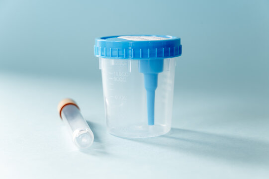Urine sample collection jar and vacuum tube on blue background, medical diagnostics and laboratory